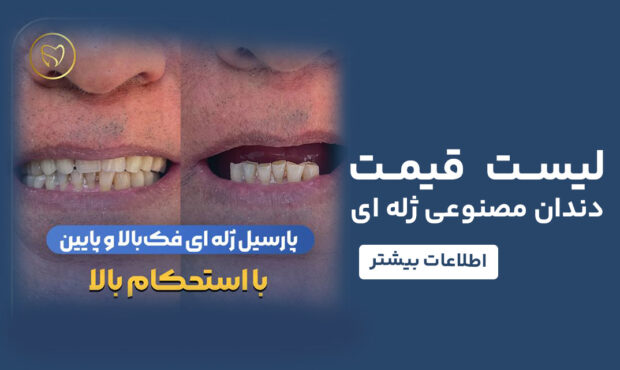 لیست قیمت دندان مصنوعی ژله ای 1404 منبع مستر دندان